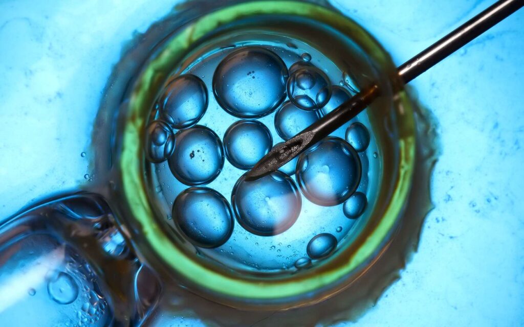 بارور کردن تخمک در آزمایشگاه با IVF