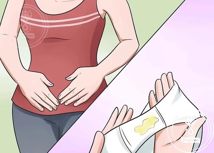 افزایش ترشحات واژن؛ نشانه رایج بارداری