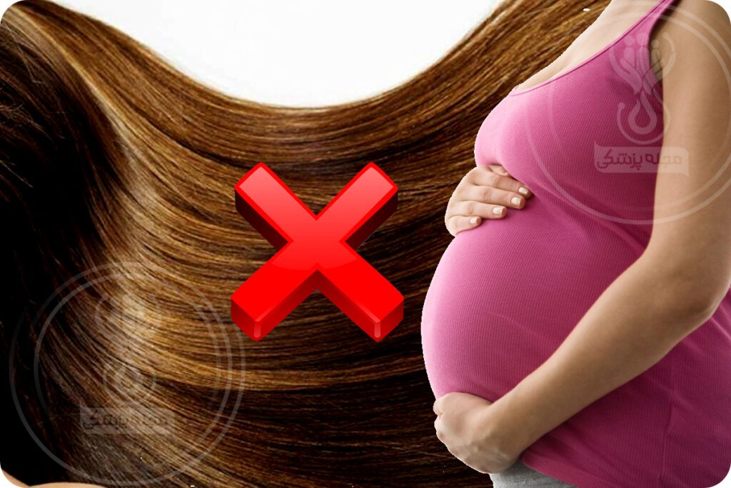 مزوتراپی در دوران بارداری