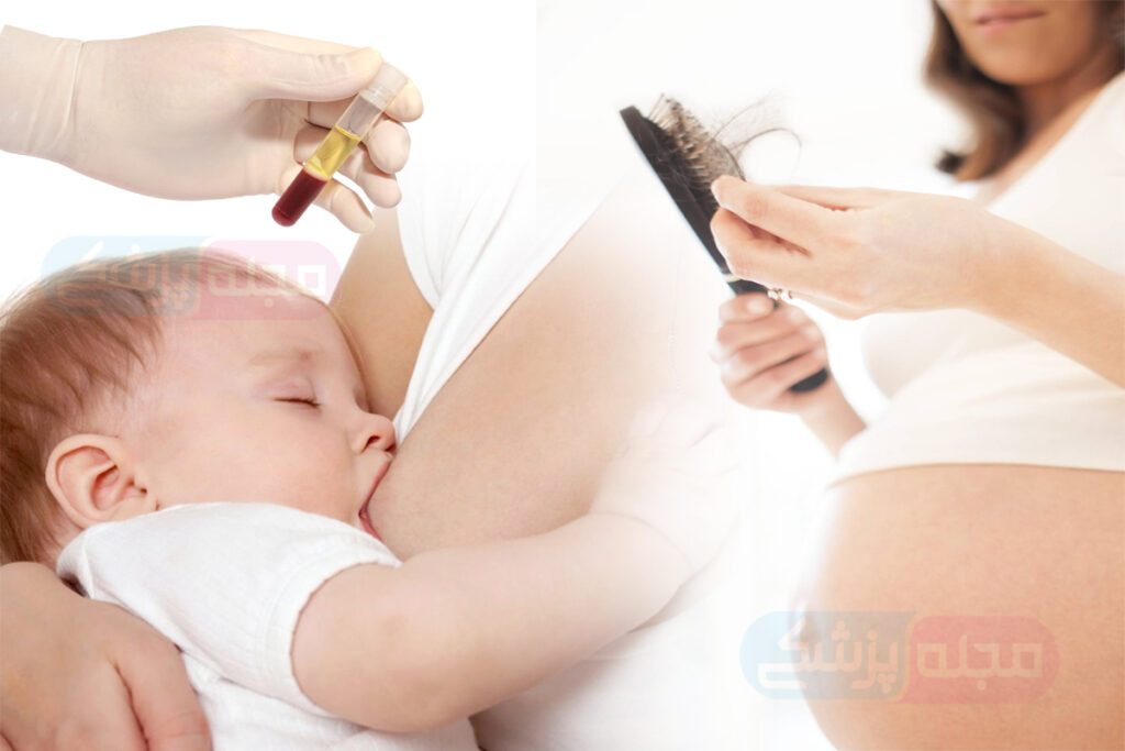 درمان ریزش مو در بارداری و شیردهی با پی آر پی (PRP)