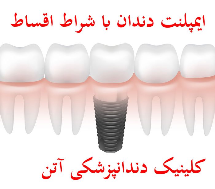 کلینیک دندان پزشکی آتن