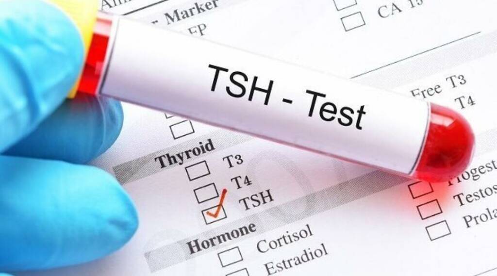 tsh-test