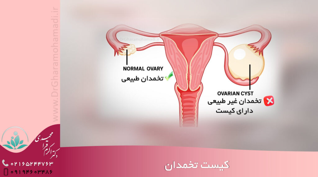 معرفی لابیاپلاستی و واژینوپلاستی