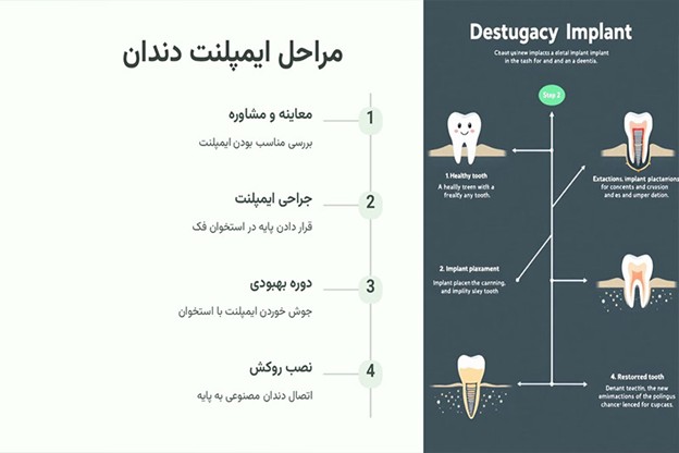 چه کسانی نباید از ایمپلنت فوری استفاده کنند؟