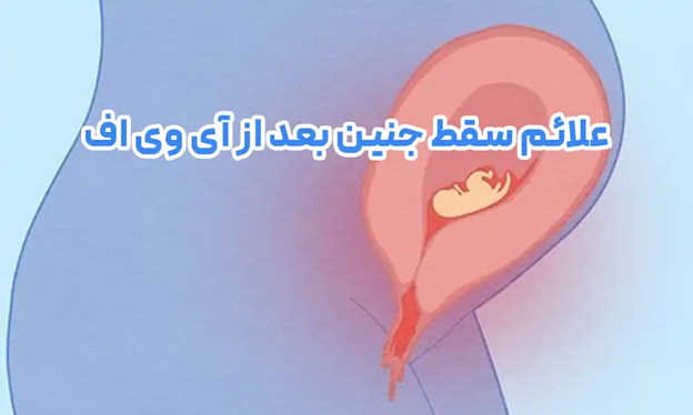 علت سقط جنین در آی وی اف و پیشگیری از خطر سقط بعد از ivf