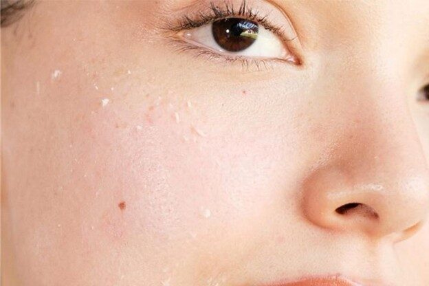 پیل شدن ضد آفتاب یعنی چه؟ چرا ضد آفتاب پیل میشه؟