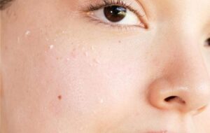 پیل شدن ضد آفتاب یعنی چه؟ چرا ضد آفتاب پیل میشه؟