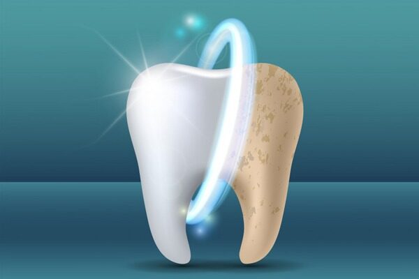 سفید کردن طبیعی دندان خوب یا بد؟