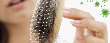 علت تا درمان قطعی ریزش مو بعد از کرونا