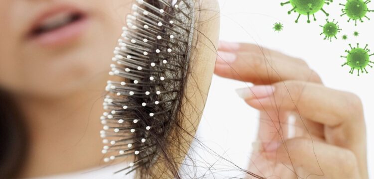 علت تا درمان قطعی ریزش مو بعد از کرونا